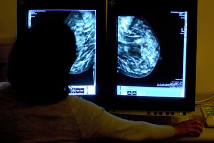 Hundreds of 'missing' cancer diagnoses in Cornwall in 2020 – as fewer found at early stage